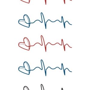 Electrocardiogram