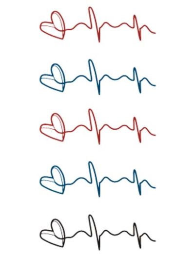 Electrocardiogram