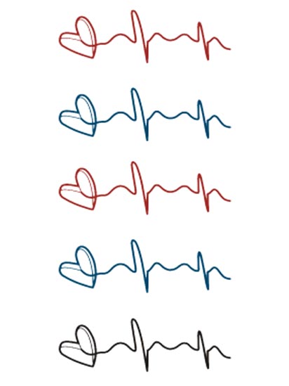 Electrocardiogram