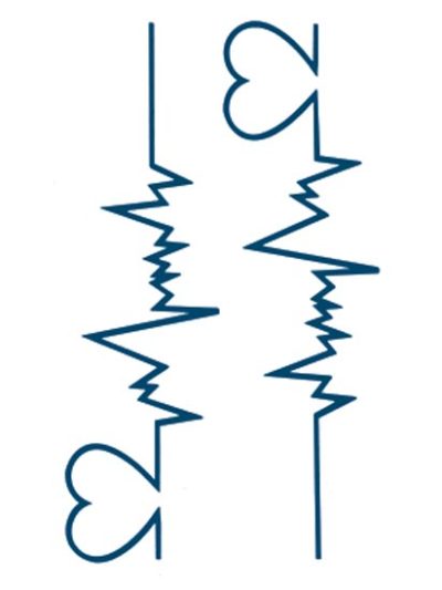 Electrocardiogram