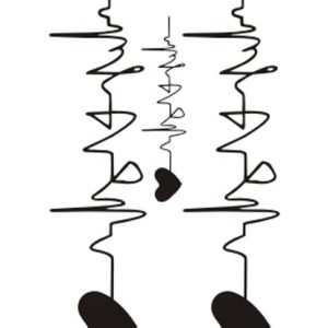 Electrocardiogram