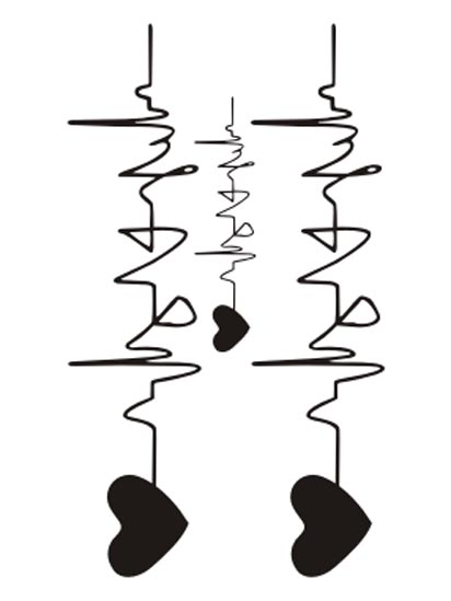 Electrocardiogram